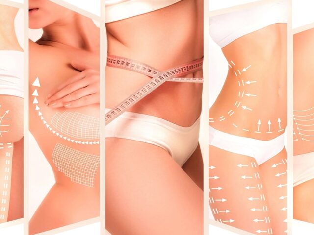 جراحات نحت الجسم