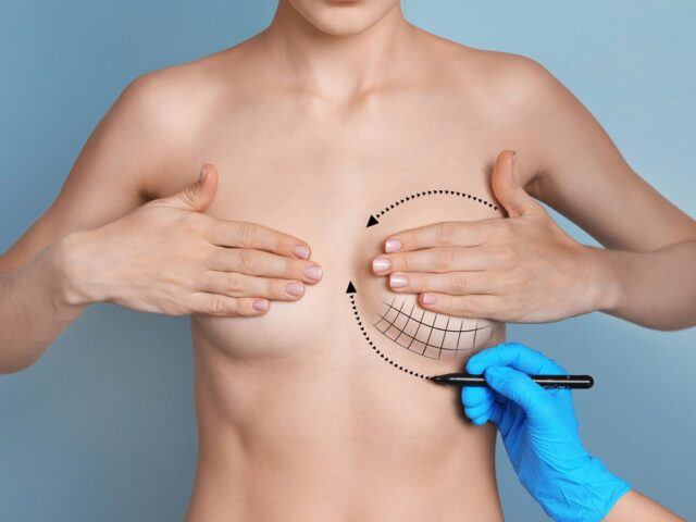 جراحات الثدي